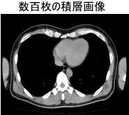 数百枚の積層画像